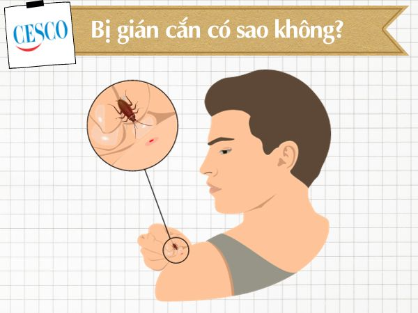 Gián Có Cắn Không Tác Hại Và Cách Xử Lý An Toàn Khi Bị Cắn 10 Bị gián cắn có sao không? Hên hay xui – CESCO VIỆT NAM