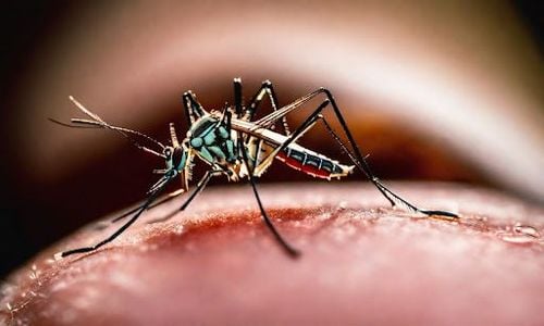 Dị ứng do muỗi đốt: Triệu chứng và phòng tránh hiệu quả | Vinmec